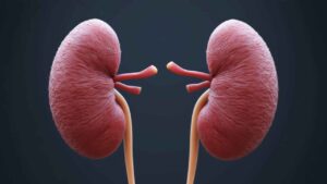 funny names for kidney stones